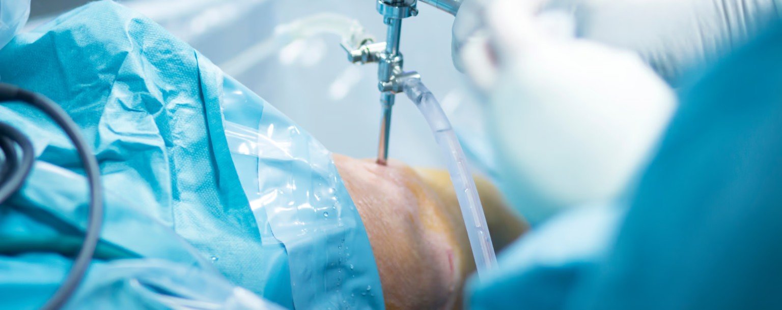 ACL surgery in Indore- Dr Prince Uchadiya