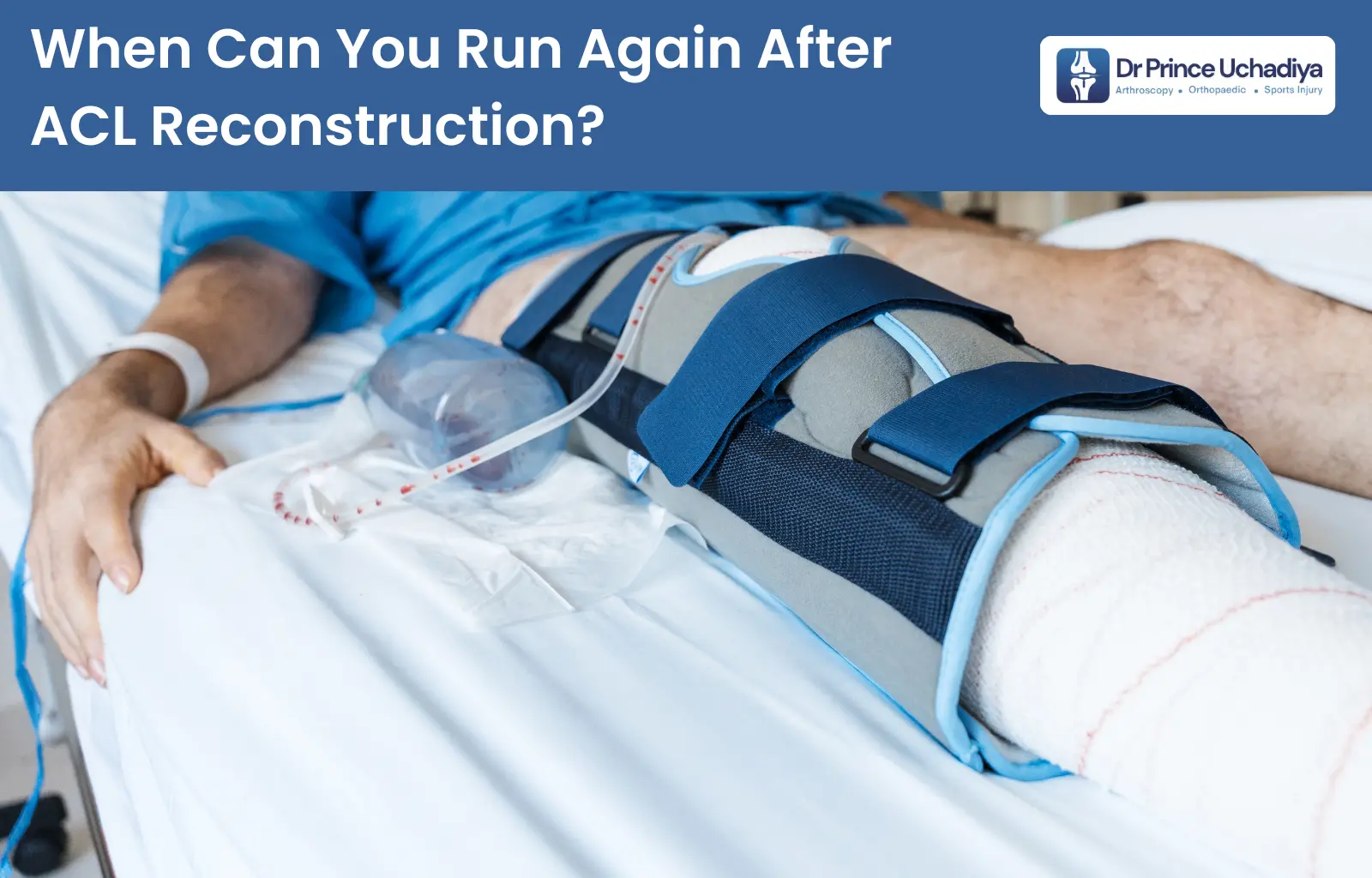 When Can You Return to Running After ACL Surgery Indore?