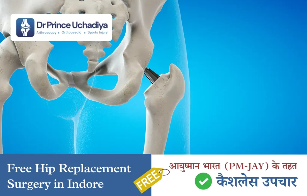 Ayushman Mein Free Hip Replacement Surgery in Indore