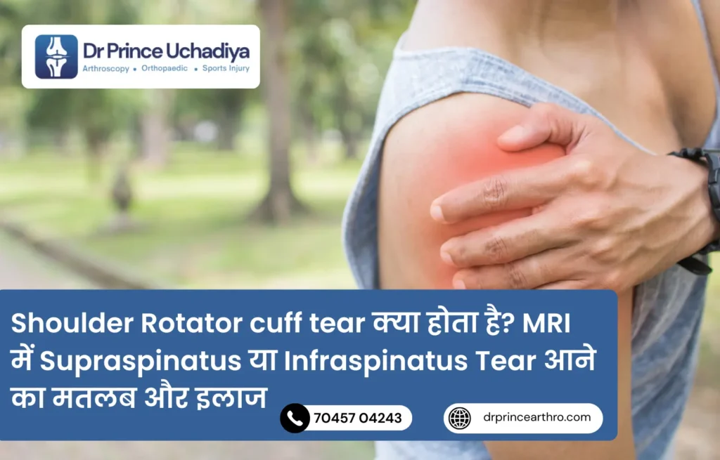 Shoulder Rotator cuff tear क्या होता है MRI में Supraspinatus या Infraspinatus Tear आने का मतलब और इलाज