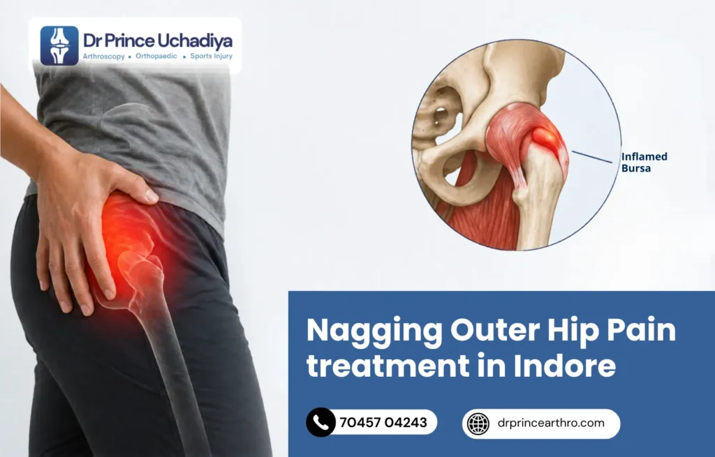 Trochanteric Bursitis Hip Pain