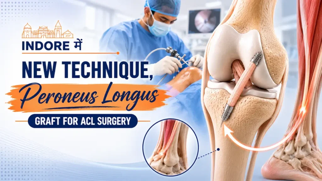 Peroneus longus graft ACL surgery in Indore showing tendon transfer from ankle to reconstructed knee