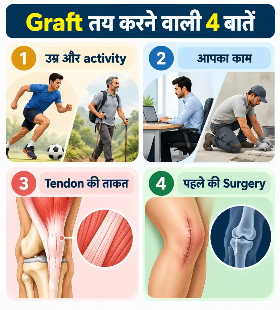 Infographic showing four factors that influence ACL graft selection: age and activity, type of work, tendon strength, and previous surgery.