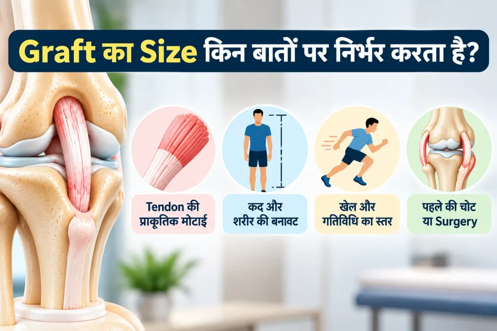 Infographic showing four factors that affect ACL graft size: natural tendon thickness, body build, activity level, and previous injury or surgery.