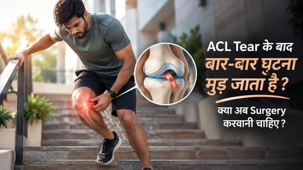 Patient experiencing repeated knee instability after an ACL tear